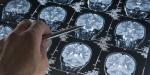 Tener un mayor nivel educativo no ralentiza el deterioro cognitivo