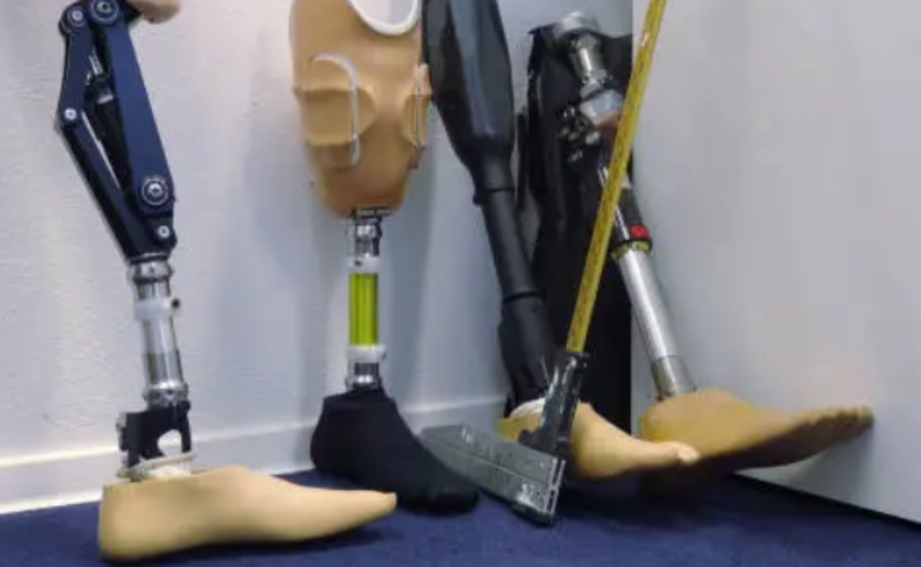 Ofrecerá Ayuntamiento prótesis de piernas sin costo
