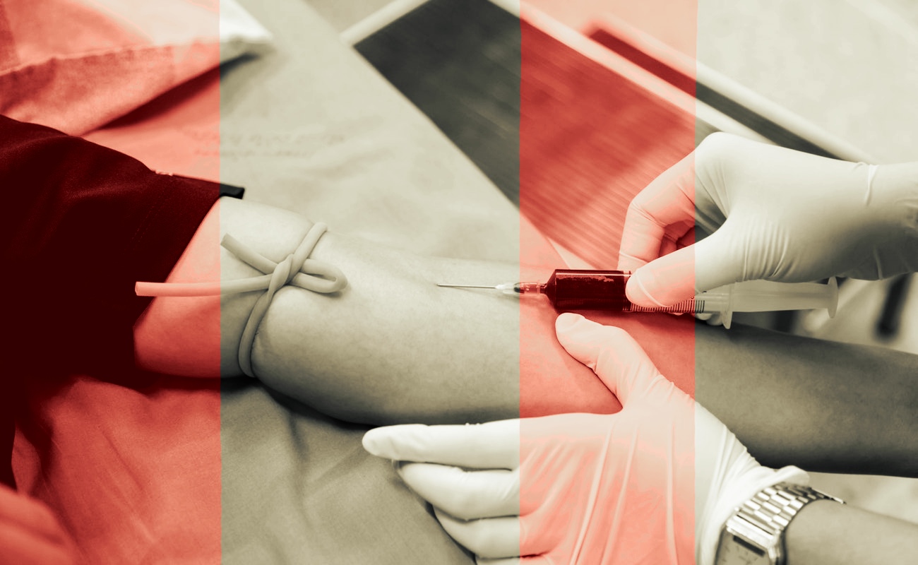 Pide CEDH a Registro Civil anular solicitud de pruebas de VIH en prenupciales