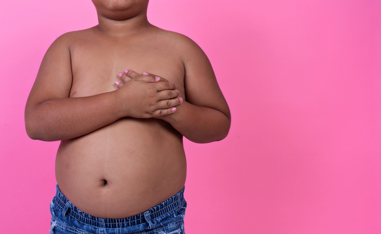 Sobrepeso eleva riesgo de hipertensión en niños, revela estudio