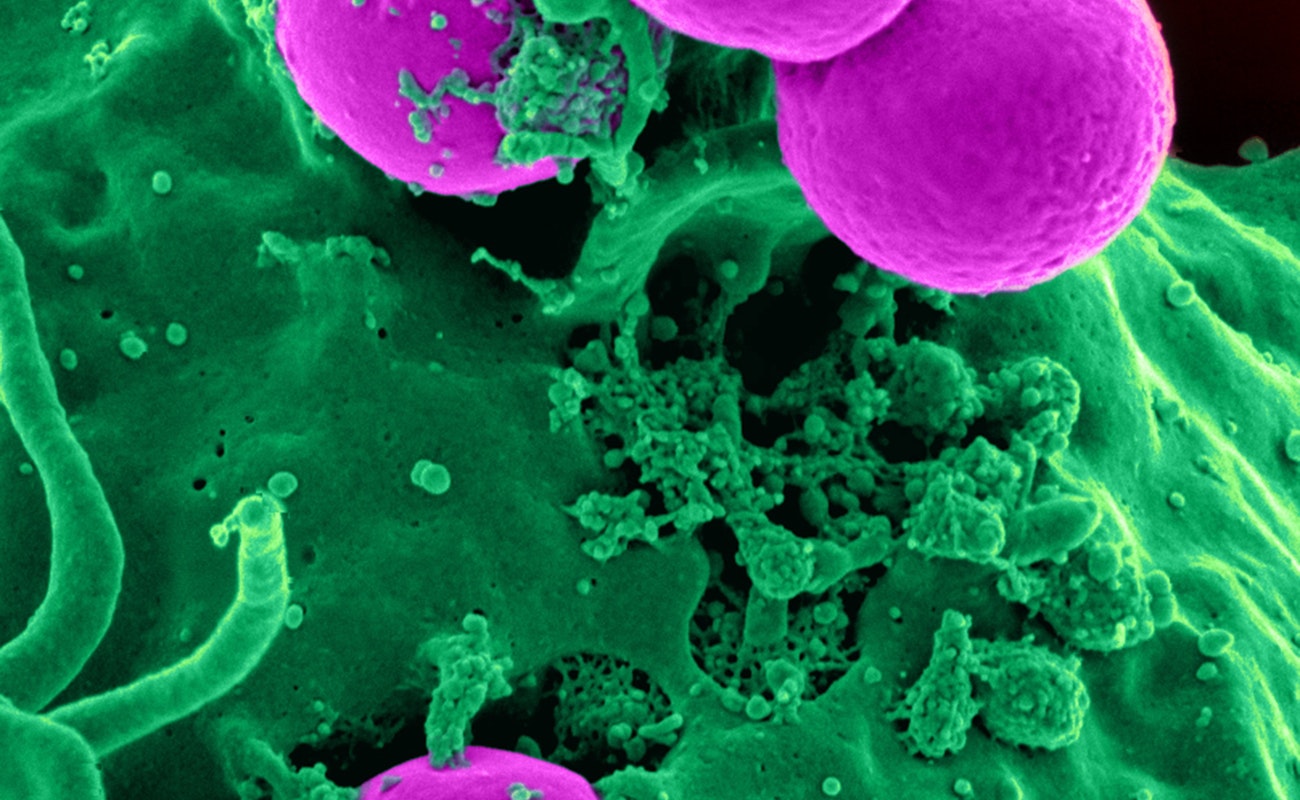 En 2050, resistencia bacteriana será primera causa de muerte