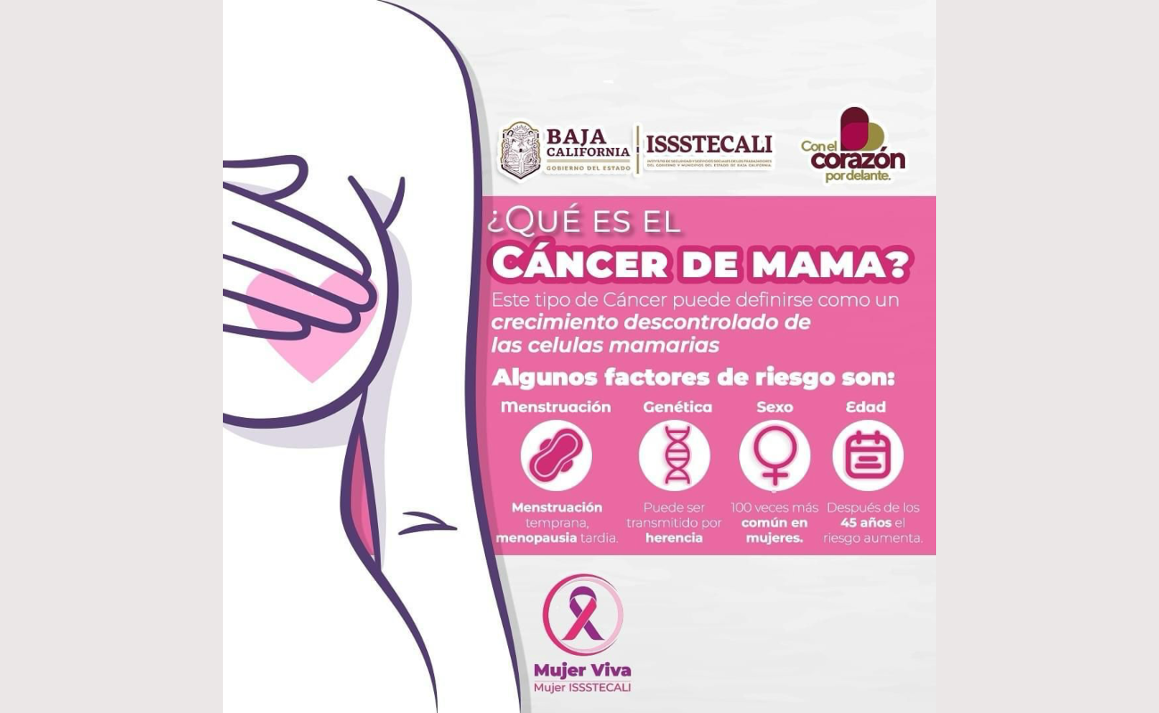 Invita ISSSTECALI a realizarse mamografías para detección oportuna del cáncer de mama