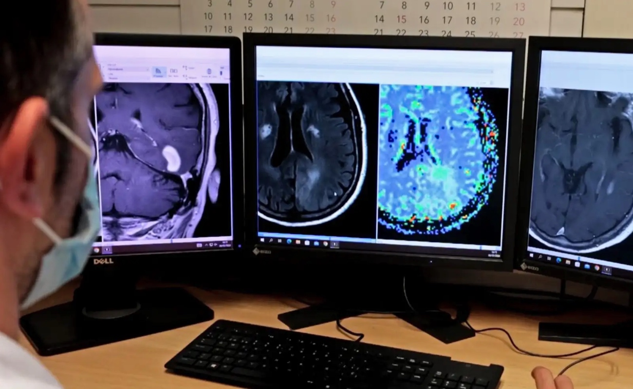 Innovadora tecnología de imágenes OCT se integra con éxito en cirugías cerebrales