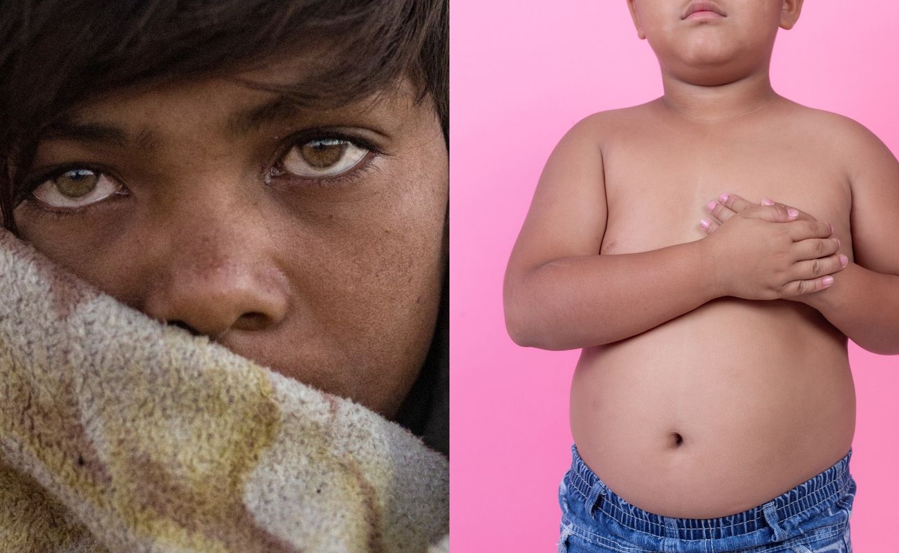 Hambruna y sobrepeso marcan Día Mundial de la Alimentación