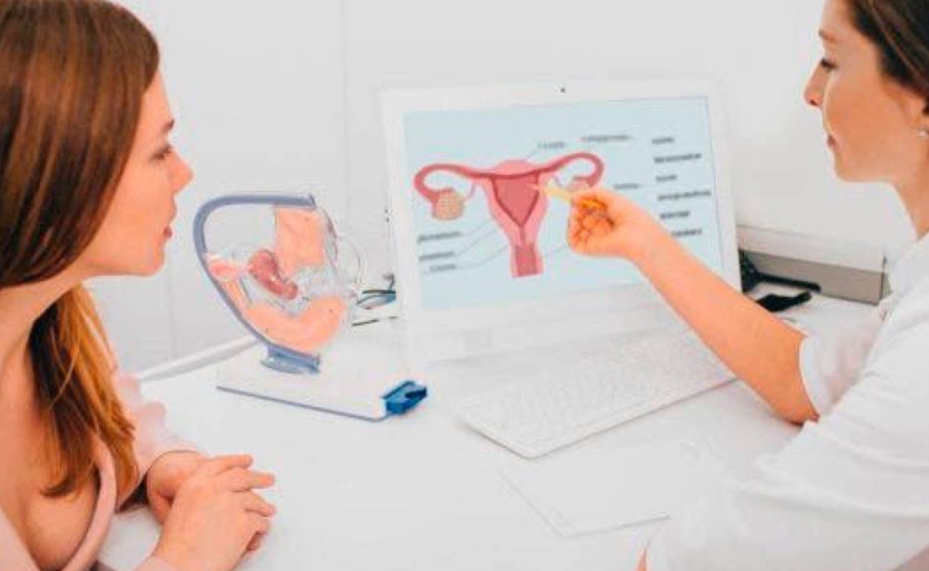 Ovario poliquístico, causa más frecuente de infertilidad en edad reproductiva