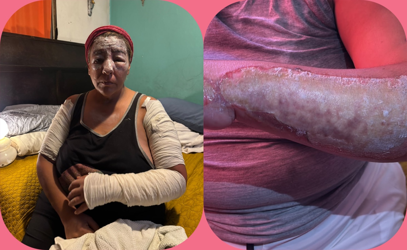 Rifa con causa busca ayudar a Karime tras incendio; hay hasta este martes para participar