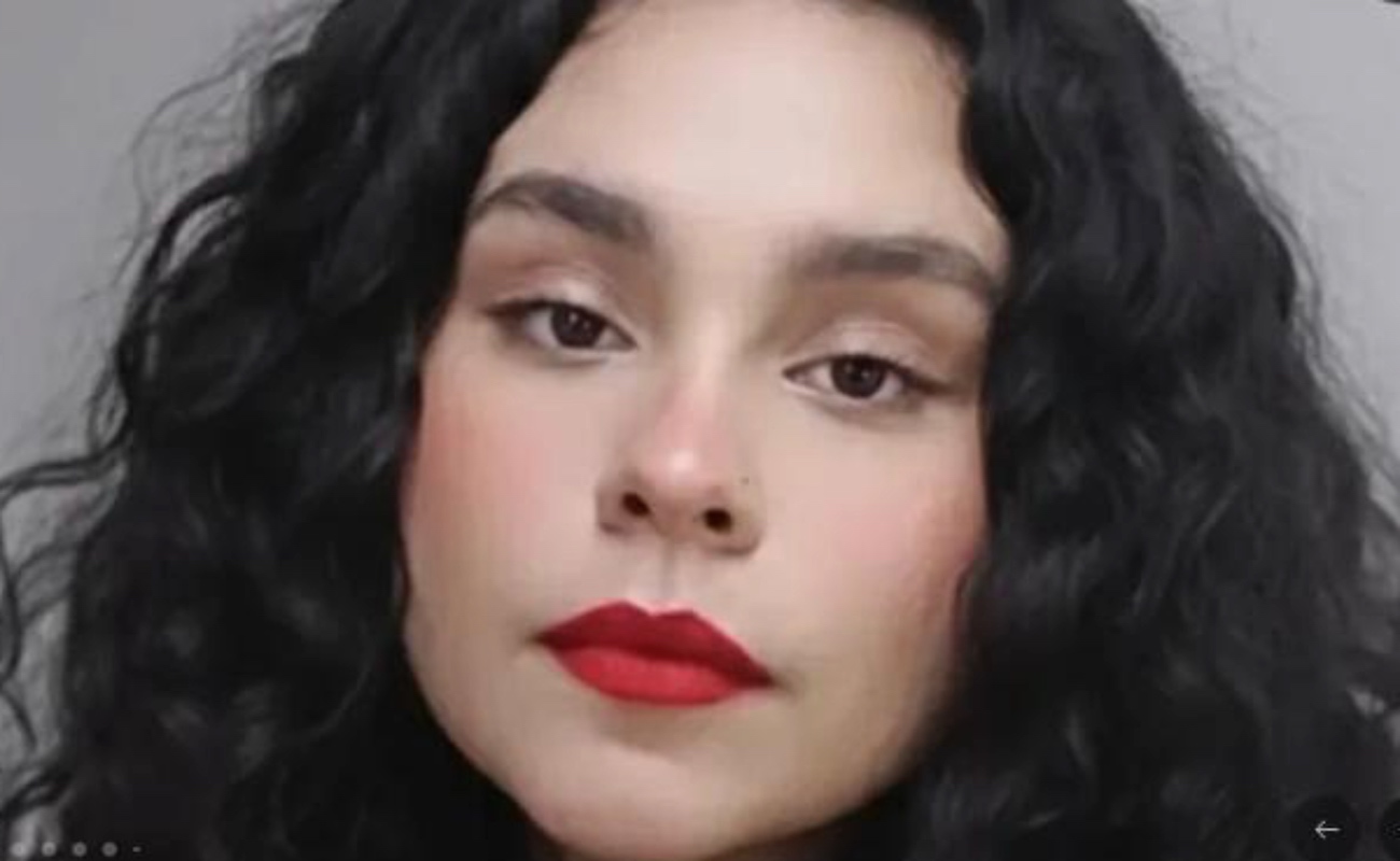 Alejandra Quintero Mariscal, bailarina profesional de Tijuana, necesita una cirugía de columna urgente debido a la espondilolistesis.