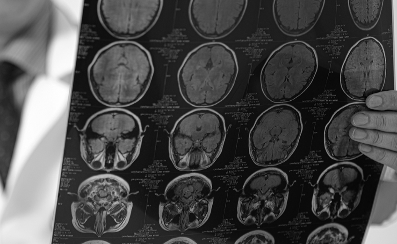 Egresados de Maestría en Neuropsicología revisan afecciones cognitivas de distintos grupos ante pandemia.