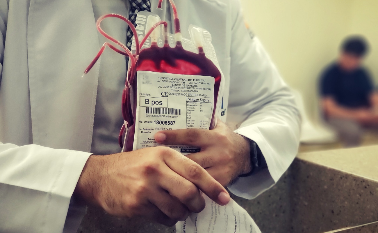 Para las donaciones de este tipo se requiere hacer una preparación de la persona donante antes de hacer el procedimiento y también del receptor.