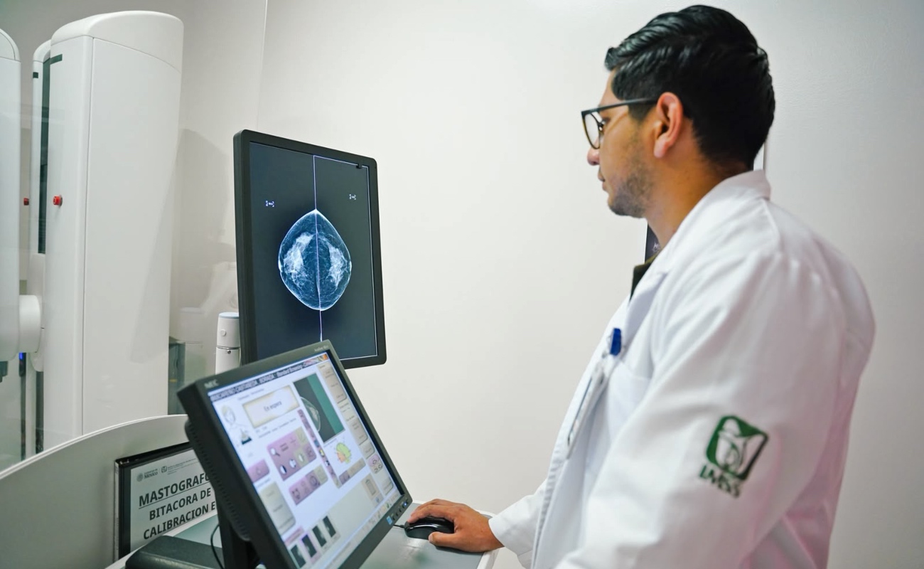 Invita IMSS Baja California a mujeres a realizarse la mastografía para detectar oportunamente el cáncer de mama