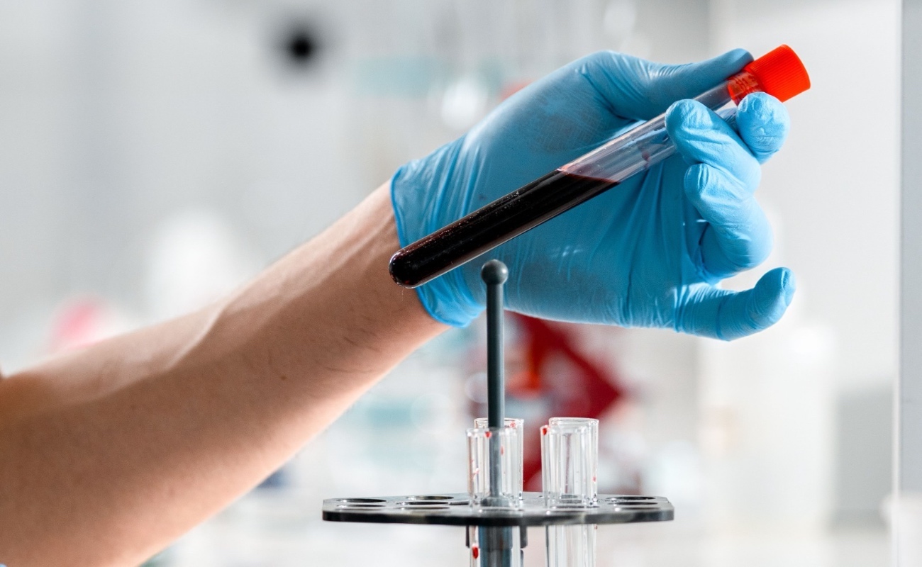 Sensibilizar a la comunidad masculina sobre la importancia de realizarse exámenes de detección oportuna del Cáncer de Próstata.