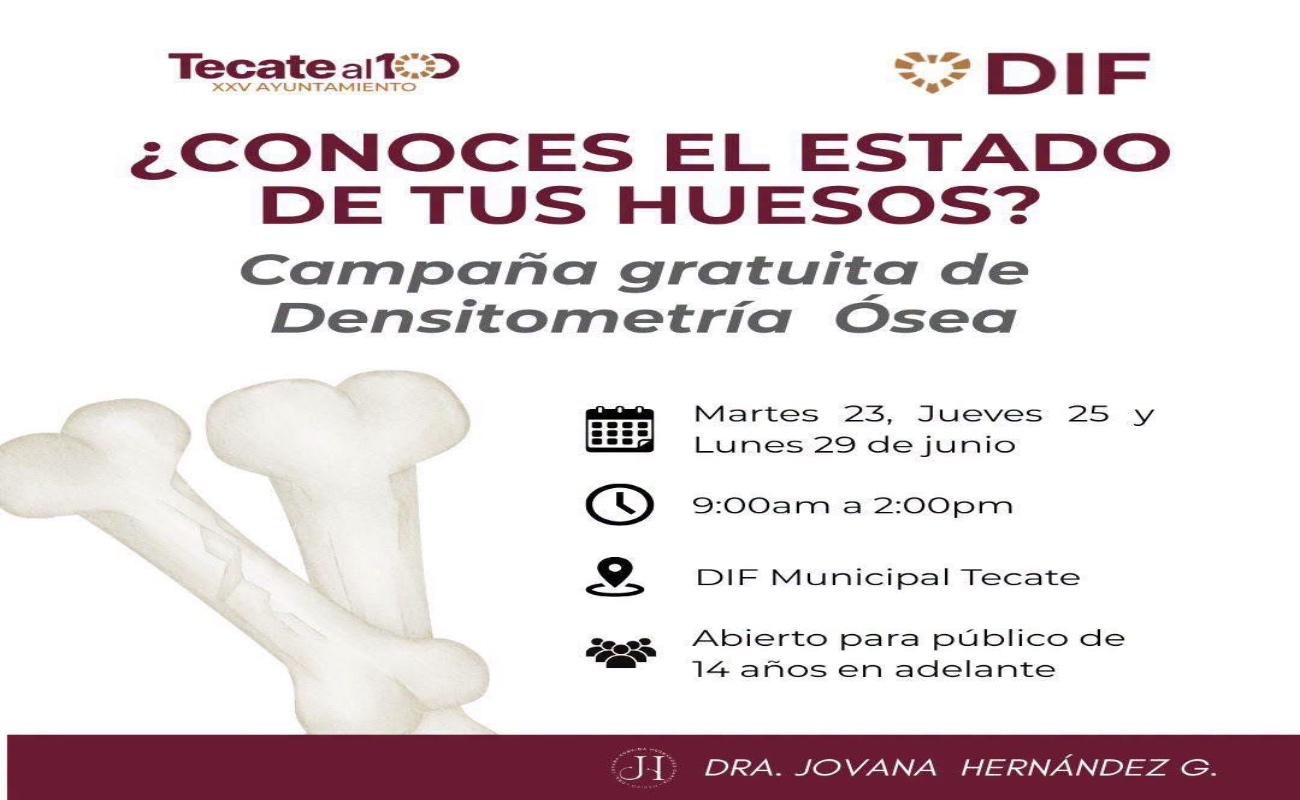 Invita DIF Tecate a participar en Campaña Gratuita de Densitometría Ósea